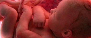 Arentina: ¡Actúe ya para que los Senadores no aprueben la ley de aborto voluntario!