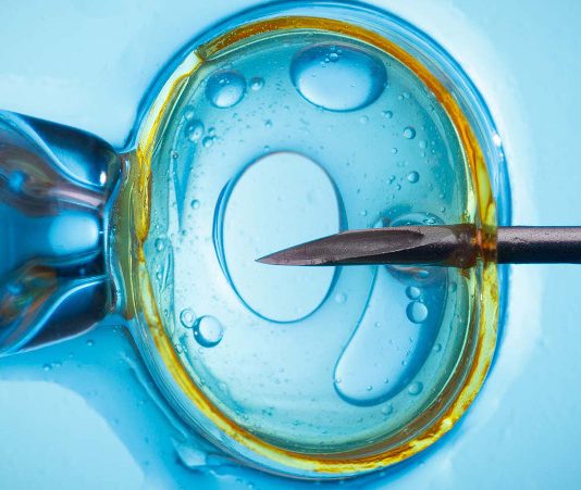 La Academia Pontificia para la Vida bajo sospecha